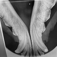 Röntgenaufnahme Zahnfüllung