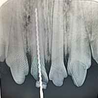 Zahnwurzelbehandlung beim Hund